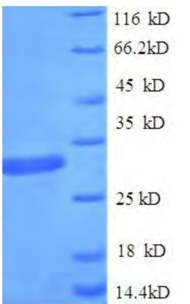 Rekombinant İnsan Kromoboks proteini homolog 7 (CBX7) (Rekombinant Protein)