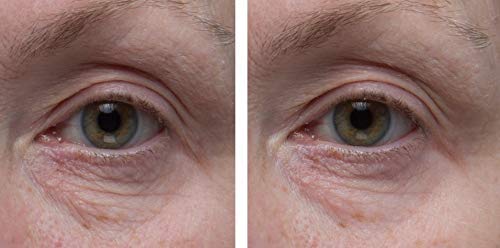 Dr. Denese SkinScience Sıkılaştırıcı Yüz Kollajen Göz Kremi Hyaluronik Asit, Skualen ve Peptidlerle Derinlemesine Nemlendirme-Geliştirilmiş